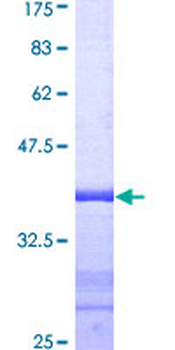 CETN1 (Human) Recombinant Protein (Q01)