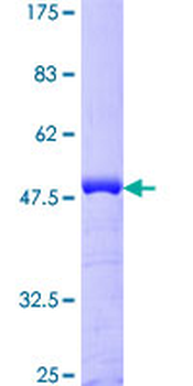 CETN1 (Human) Recombinant Protein (P01)