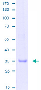 CD52 (Human) Recombinant Protein (P01)