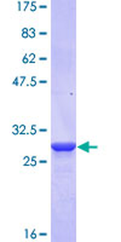 CDSN (Human) Recombinant Protein (Q01)
