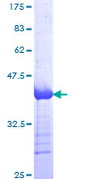 CDH5 (Human) Recombinant Protein (Q01)