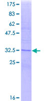 CD81 (Human) Recombinant Protein (Q01)