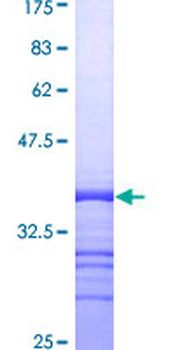 CD9 (Human) Recombinant Protein (Q01)