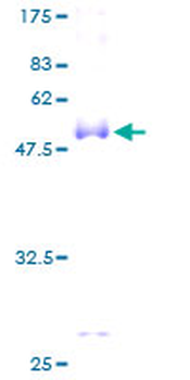 CD8A (Human) Recombinant Protein (P01)
