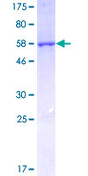 CBR1 (Human) Recombinant Protein (P01)