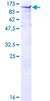 CAST (Human) Recombinant Protein (P01)