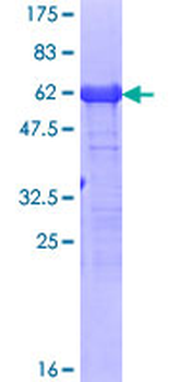 CAPG (Human) Recombinant Protein (P01)
