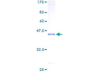 CALML3 (Human) Recombinant Protein (P01)
