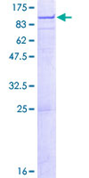 C1R (Human) Recombinant Protein (P02)