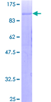 C1R (Human) Recombinant Protein (P01)