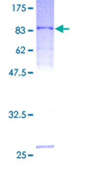 SERPING1 (Human) Recombinant Protein (P01)