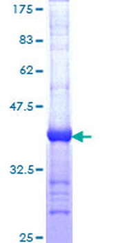 DST (Human) Recombinant Protein (Q01)
