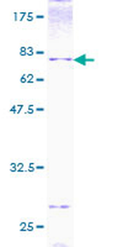 BMP7 (Human) Recombinant Protein (P01)