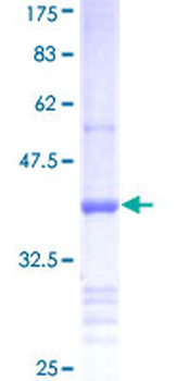 BMP3 (Human) Recombinant Protein (Q01)