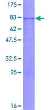 BMP3 (Human) Recombinant Protein (P01)