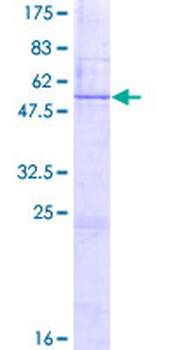 BDNF (Human) Recombinant Protein (P02)