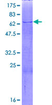 BCAT2 (Human) Recombinant Protein (P01)