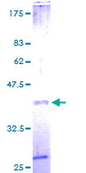 B2M (Human) Recombinant Protein (P01)