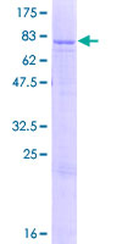 ATP5A1 (Human) Recombinant Protein (P01)