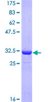 ATOX1 (Human) Recombinant Protein (Q01)