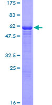 ASPA (Human) Recombinant Protein (P01)
