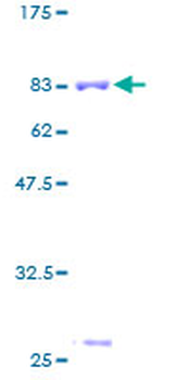 ASL (Human) Recombinant Protein (P01)