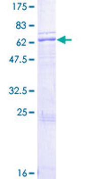 APOH (Human) Recombinant Protein (P01)