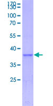 APOC3 (Human) Recombinant Protein (P01)