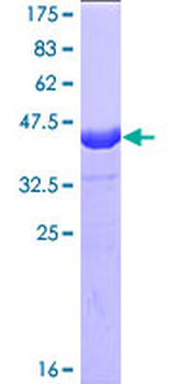 BIRC5 (Human) Recombinant Protein (P01)