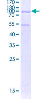 ANGPT2 (Human) Recombinant Protein (P01)
