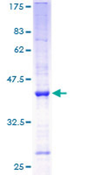 ANG (Human) Recombinant Protein (P01)