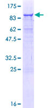 AMBN (Human) Recombinant Protein (P01)