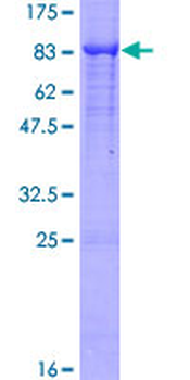 ALPP (Human) Recombinant Protein (P01)