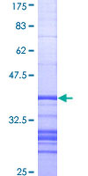 ALPL (Human) Recombinant Protein (Q01)