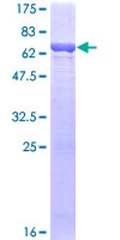 ALDOA (Human) Recombinant Protein (P01)