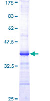 AKT1 (Human) Recombinant Protein (Q01)
