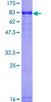 AKT1 (Human) Recombinant Protein (P01)