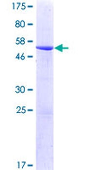 AK3L1 (Human) Recombinant Protein (P02)
