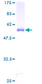 AK3L1 (Human) Recombinant Protein (P01)