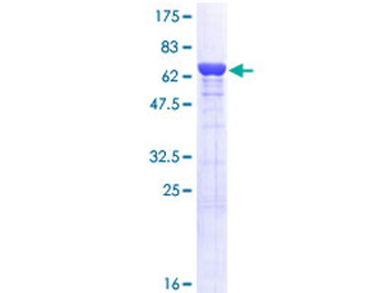 AHCY (Human) Recombinant Protein (P01)