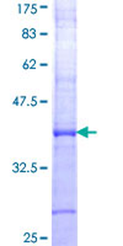 AGTR1 (Human) Recombinant Protein (Q01)