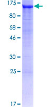 AP1B1 (Human) Recombinant Protein (P01)