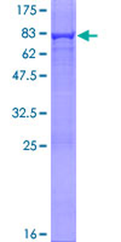 ADSL (Human) Recombinant Protein (P01)