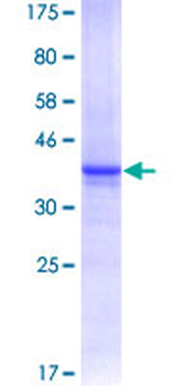 ACVR2B (Human) Recombinant Protein (Q01)