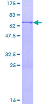 ACVR2B (Human) Recombinant Protein (P01)