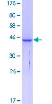 ACP1 (Human) Recombinant Protein (P01)