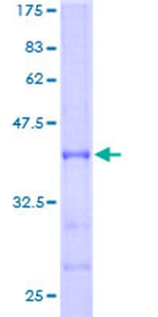 ABAT (Human) Recombinant Protein (P01)