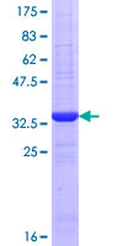 AANAT (Human) Recombinant Protein (Q01)