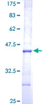 AADAC (Human) Recombinant Protein (Q01)