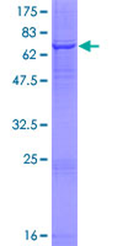 AADAC (Human) Recombinant Protein (P01)